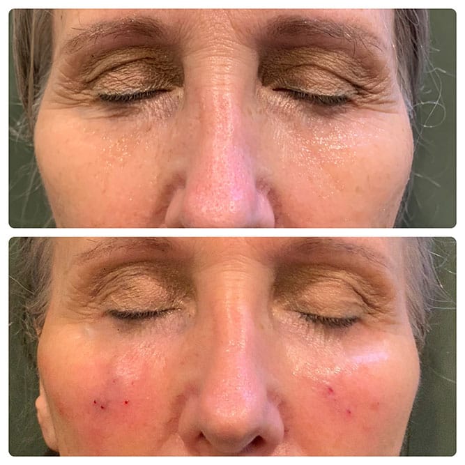 client