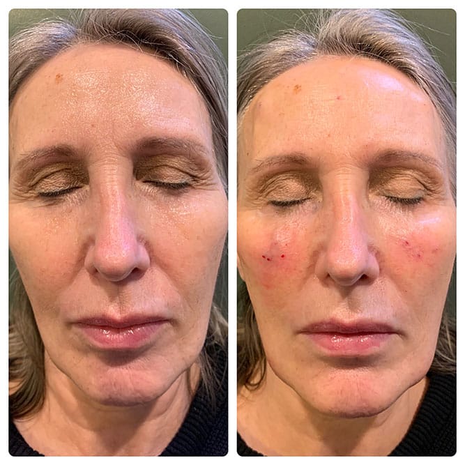 client